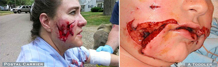 Image of two dog bite victims
